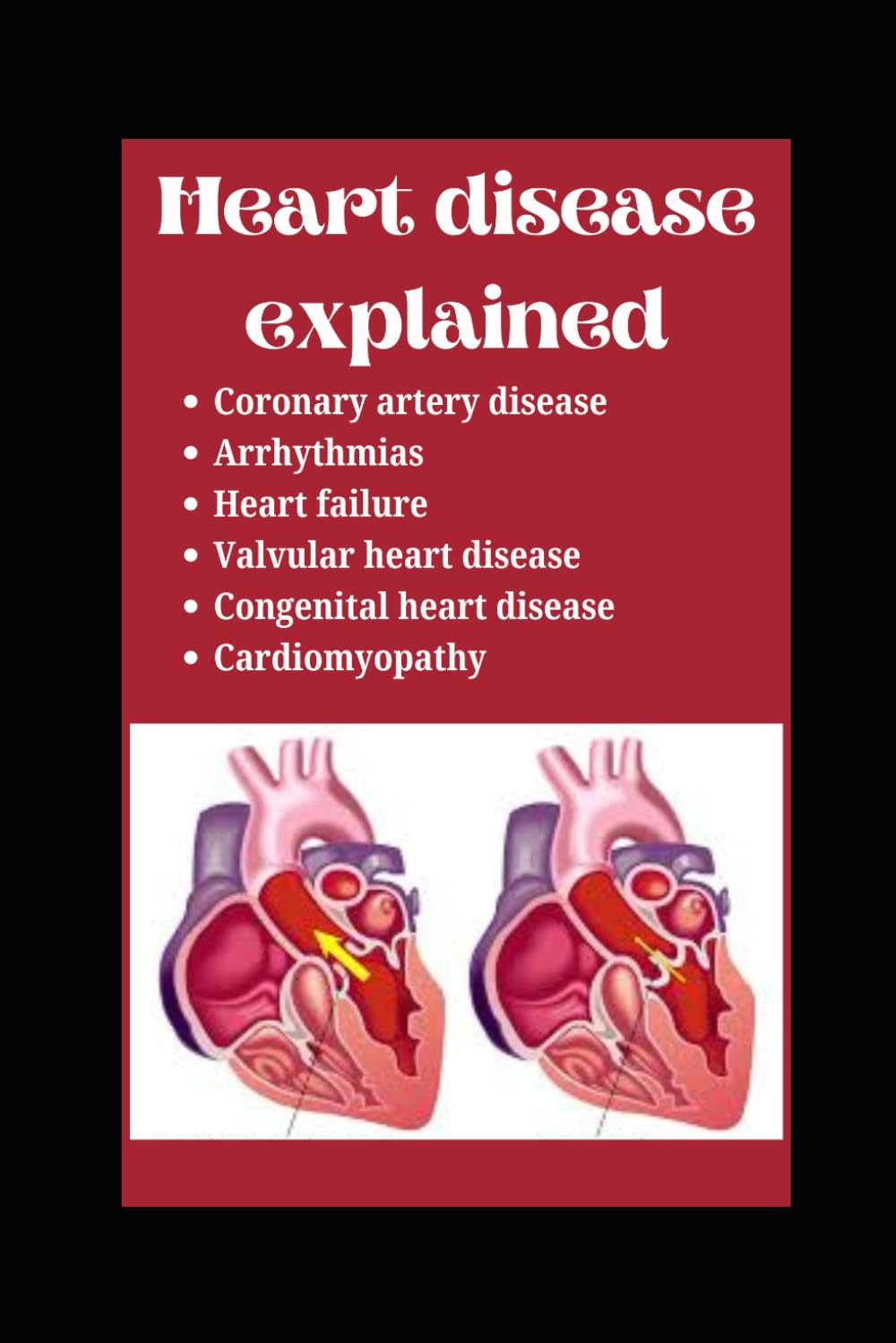 Heart disease explained Common Types of Heart Disease and Their
