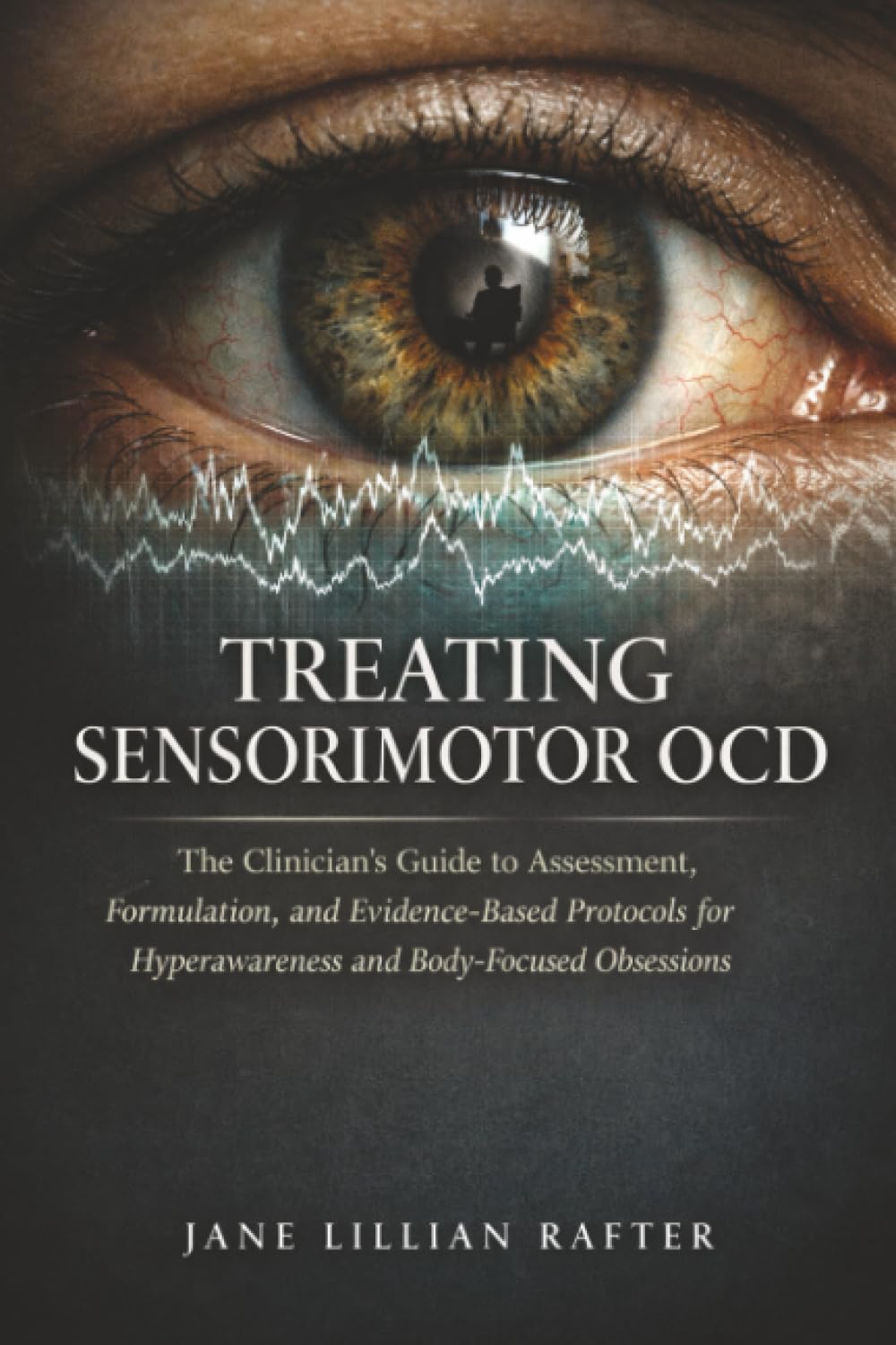Treating Sensorimotor OCD: The Clinician's Guide to Assessment, Formulation, and Evidence-Based Protocols for Hyperawareness and Body-Focused Obsessions