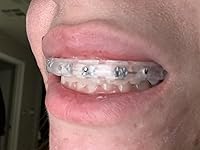 Review Image by Amazon Customer Amazon Customer