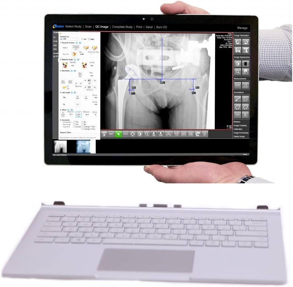 Radlink DR PRO TABLET Direct Radiography System with Flat Panel Detector