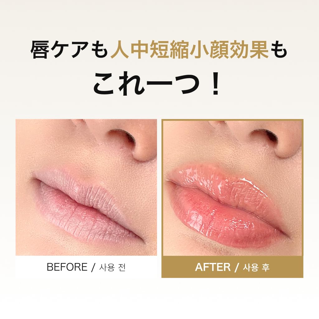 Amazon | AYDA エイダ ダーマリッププランパー5ml 美容液成分100