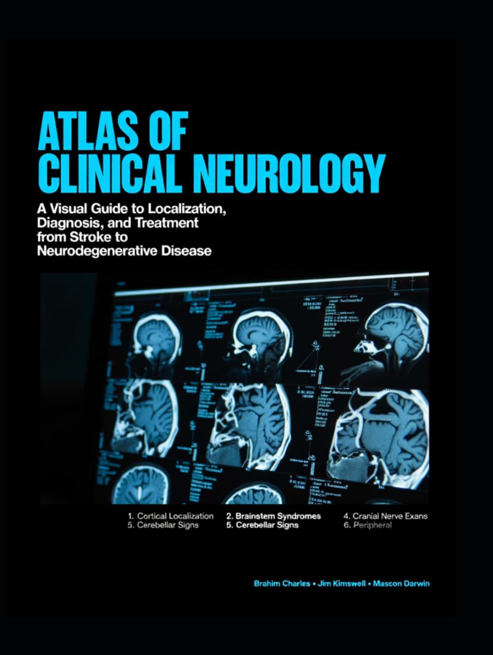 ATLAS OF CLINICAL NEUROLOGY: A Visual Guide to Localization, Diagnosis, and Treatment from Stroke to Neurodegenerative Disease