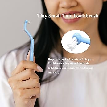 Amazon.com : FRUTA Orthodontic Toothbrush 4pcs Tuft Toothbrush