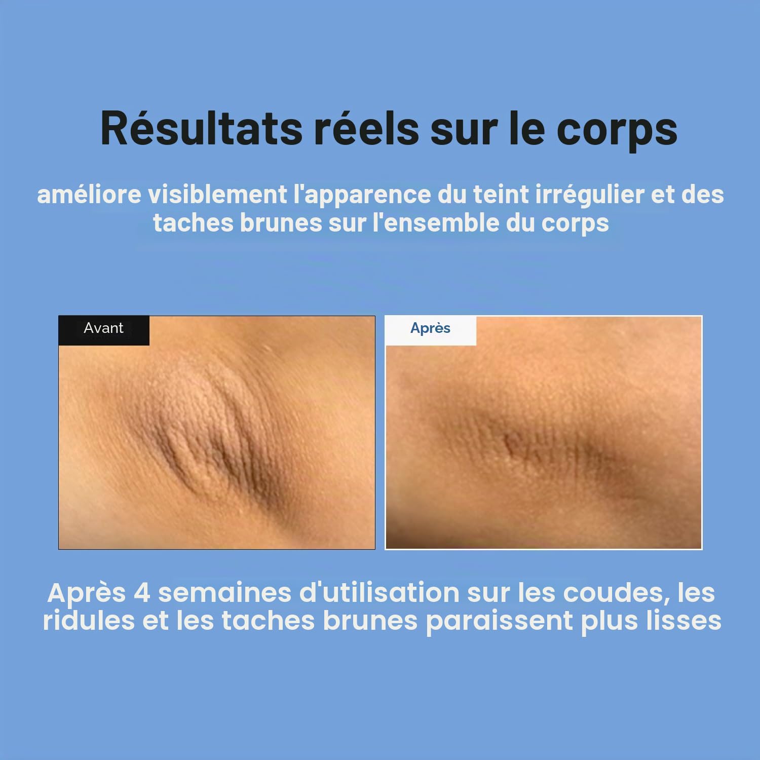 MEDITHERAPY Sérum Retinal Skin Booster, Adapté Aux Débutants, Anti-Âge, Rétinol Non Irritant Pour Le Visage Et Le Corps, Minimise Les Pores, Traitement Des Rides, 150 Ml, Jaune