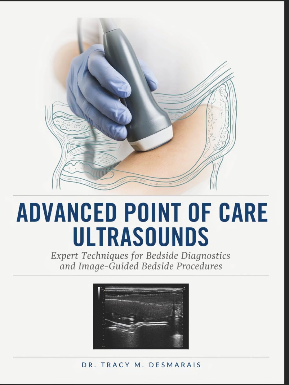 ADVANCED POINT OF CARE ULTRASOUNDS: Expert Techniques for Bedside Diagnostics and Image-Guided Bedside Procedures