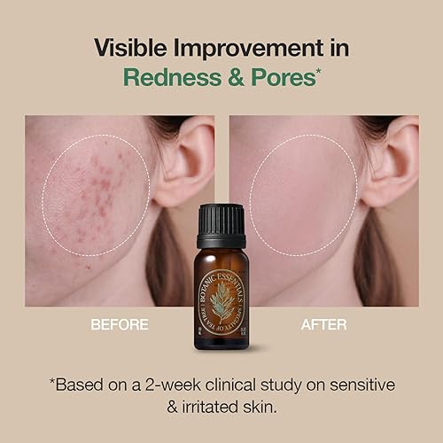 Miniatura 2 de Aceite de árbol de té 100 | Vegano | para pieles propensas al acné y con problemas | Alta concentración de 100% aceite, cuidado de la piel coreano