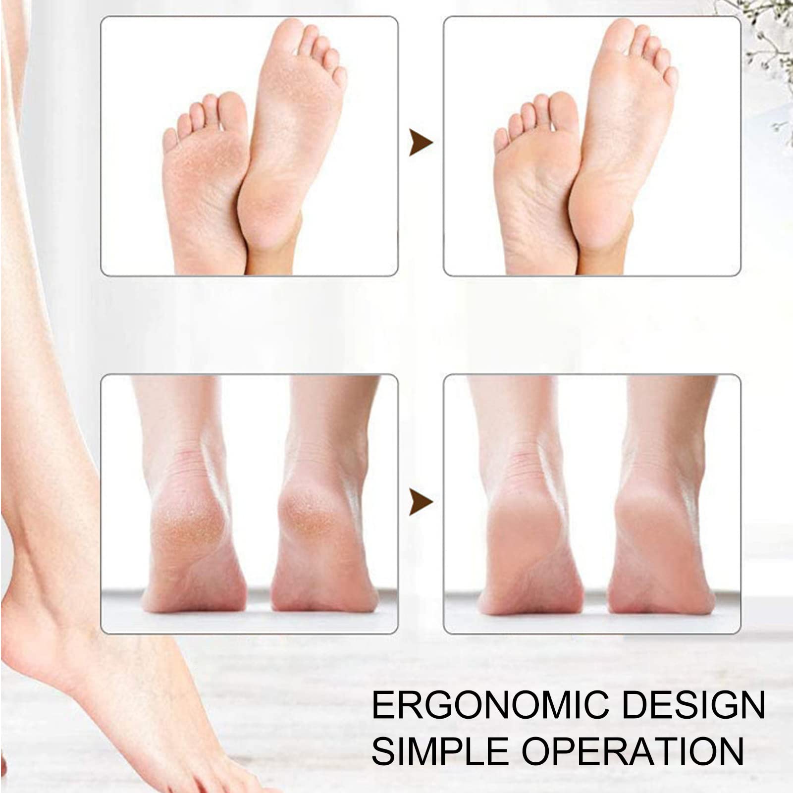 2 poziomy prędkości elektryczna szlifierka do stóp elektryczne urządzenie do usuwania zrogowaciałego naskórka Usb ładowanie elektryczne narzędzia do Pedicure do spłaszczania upartych modzeli martwa
