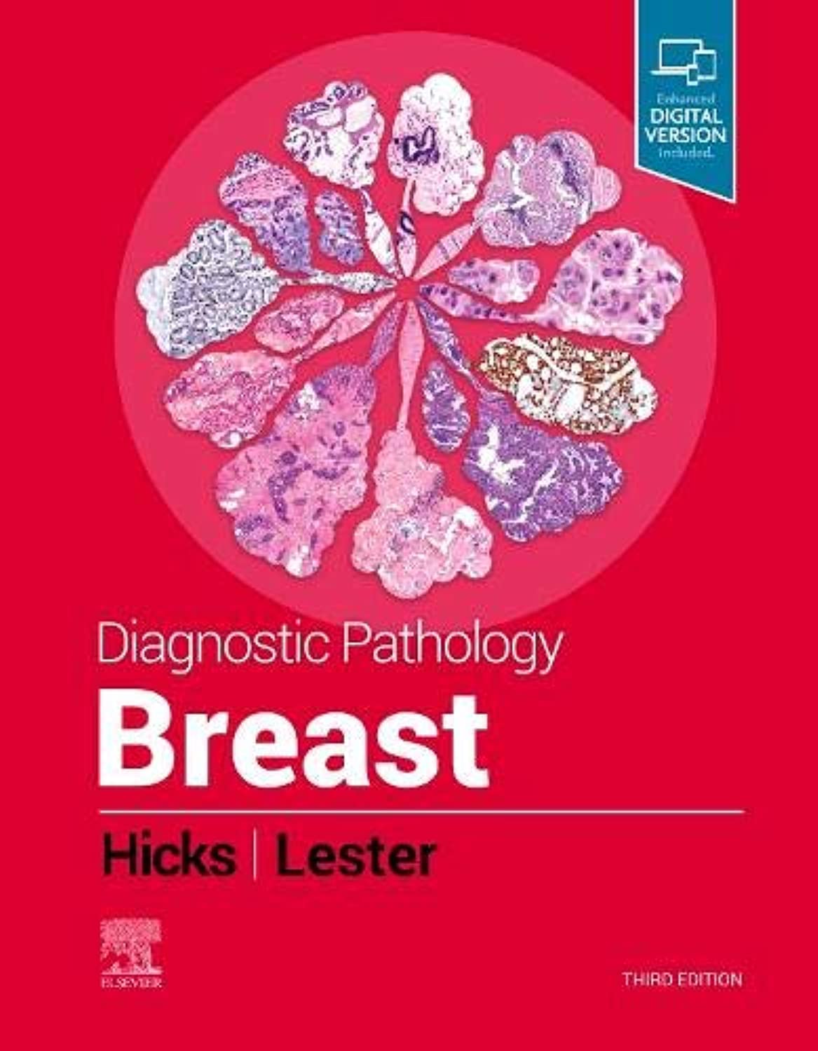 Elsevier - Health Sciences Division Diagnostic Pathology: Breast