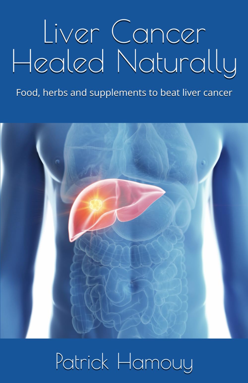 Liver cancer healed naturally: Food, herbs and supplements to beat liver cancer