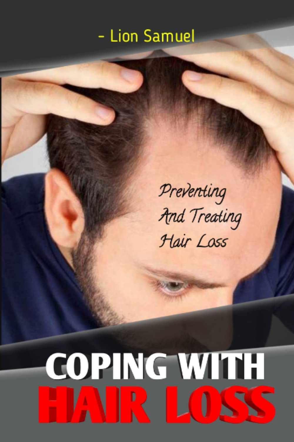 COPING WITH HAIR LOSS: Preventing And Treating Hair Loss