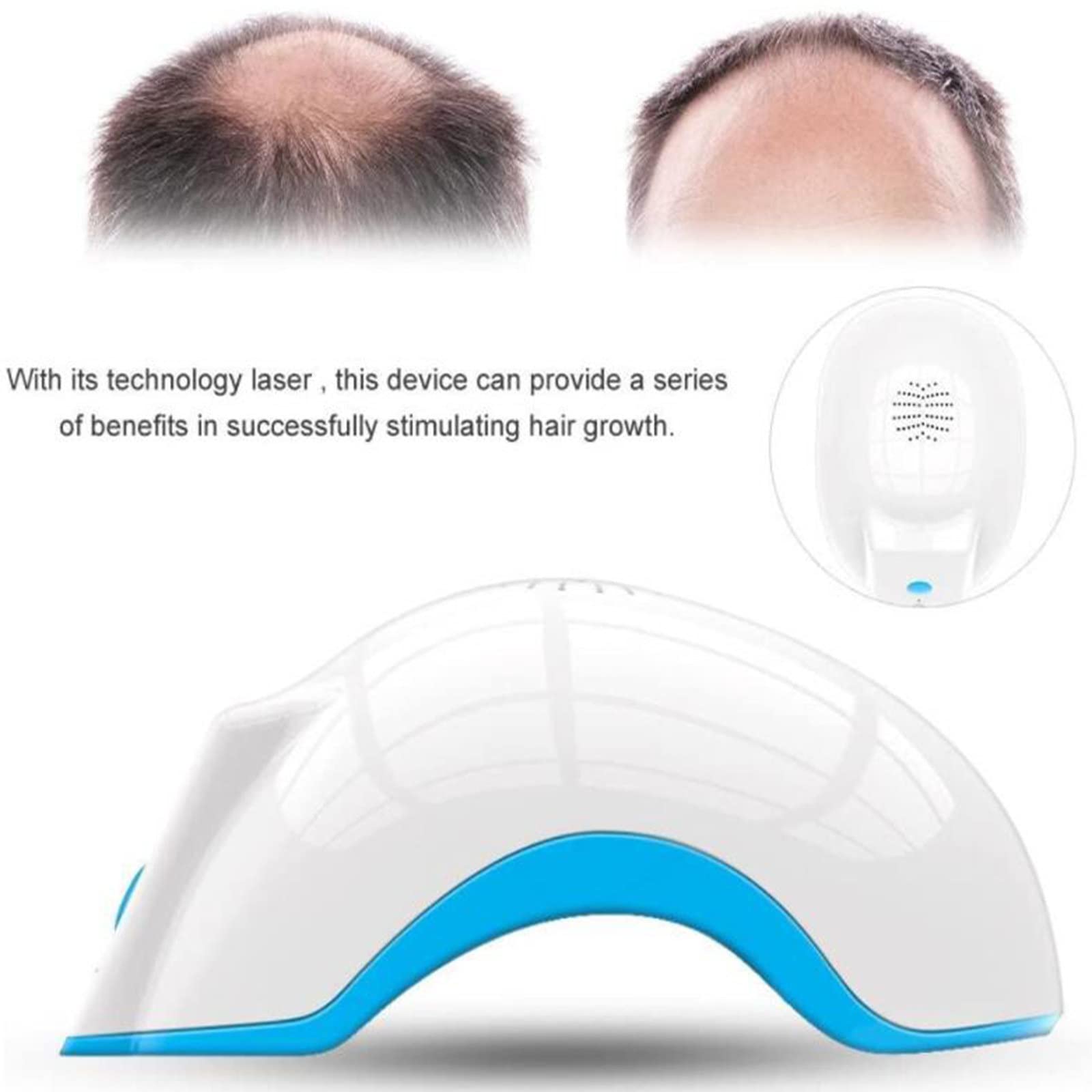 Kask Na Porost WłOsóW,System Wzrostu WłOsóW Nasadki Laserowej,Lasery Diodowe 80 Niskopoziomowa Terapia Laserowa,Produkty do Leczenia Wypadania WłOsóW Promują Przerzedzenie Odrastania WłOsóW