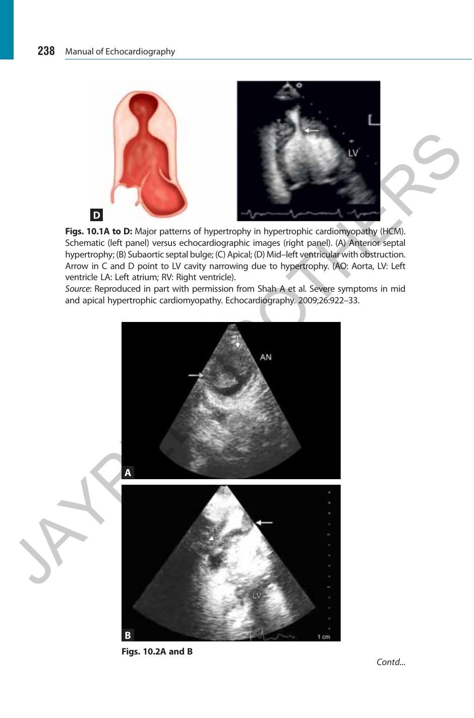 Manual of Echocardiography