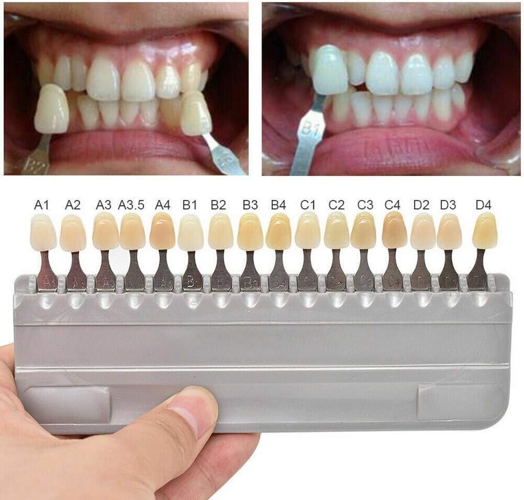 3D-Master Teeth Whitening Shade Guide 29 Colors Set Replacement for Vita Classical Tooth Bleaching Shade Chart Mold - Tracking & Comparing - Dental Material Equipment - Oral Care