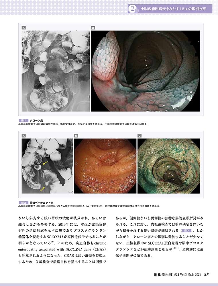 消化器内科 第22号(Vol.3 No.9,2021)特集:広義の炎症性腸疾患