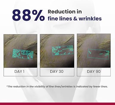RE' EQUIL 0.1% Retinol Night Cream Repairs Wrinkles Fine Lines Improves Skin Firmness, Suitable for Beginners of All Skin Types, 30g