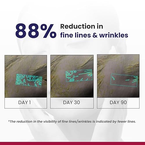 Miniatura 5 de RE' EQUIL Crema de noche con retinol al 0.1%  Repara arrugas y líneas finas  Mejora la firmeza de la piel  Apto para principiantes  Todo tipo de