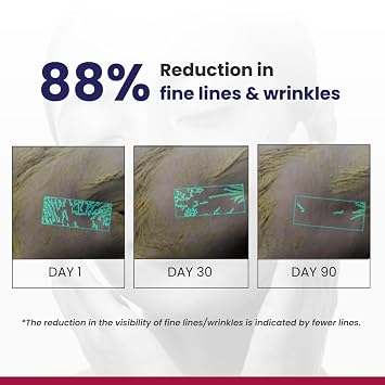RE' EQUIL 0.1% Retinol Night Cream | Repairs Wrinkles & Fine Lines | Improves Skin Firmness | Beginner Friendly | All Skin Types | 30G