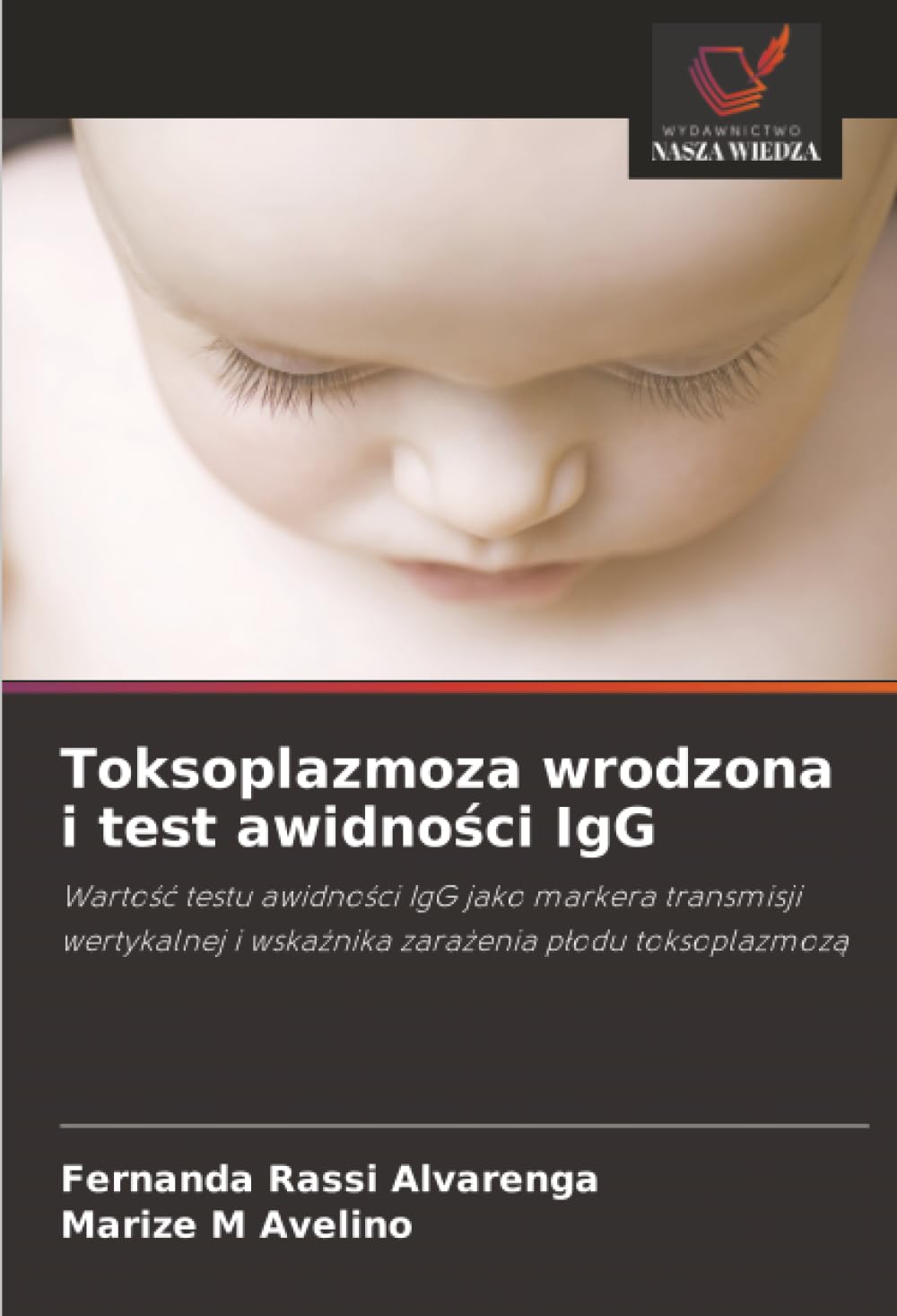 Toksoplazmoza wrodzona i test awidności IgG: Warto¿¿ testu awidno¿ci IgG jako markera transmisji wertykalnej i wska¿nika zara¿enia p¿odu toksoplazmoz¿