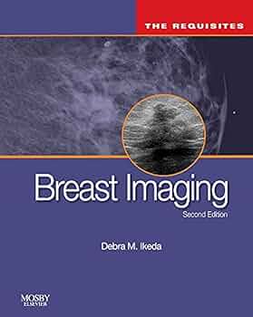 Breast Imaging: 9780323051989: Medicine & Health Science Books