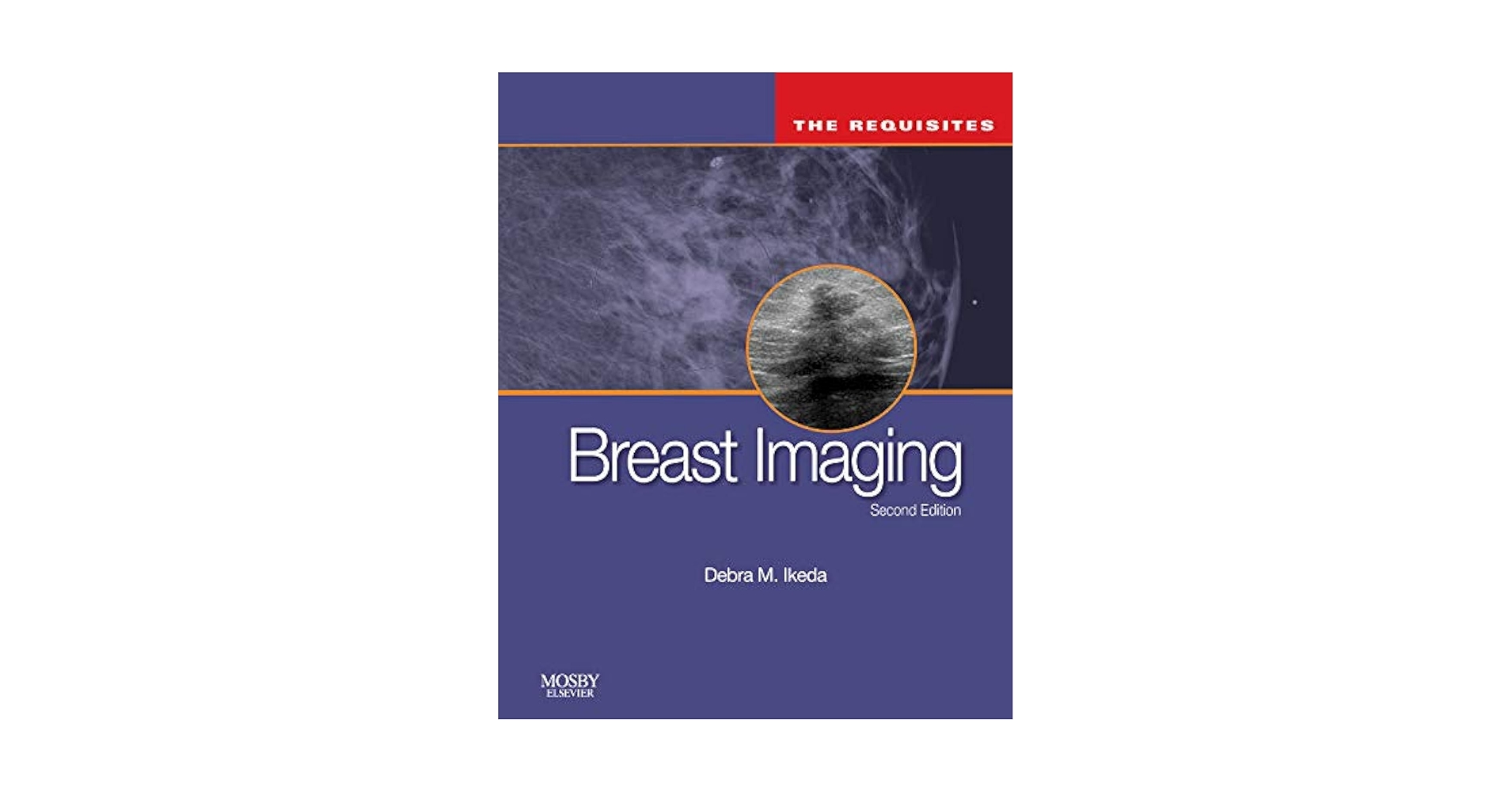 Diagnostic Breast Imaging 第2版 Diagnostic Breast Imaging 第2版 Diagnostic Breast Imaging