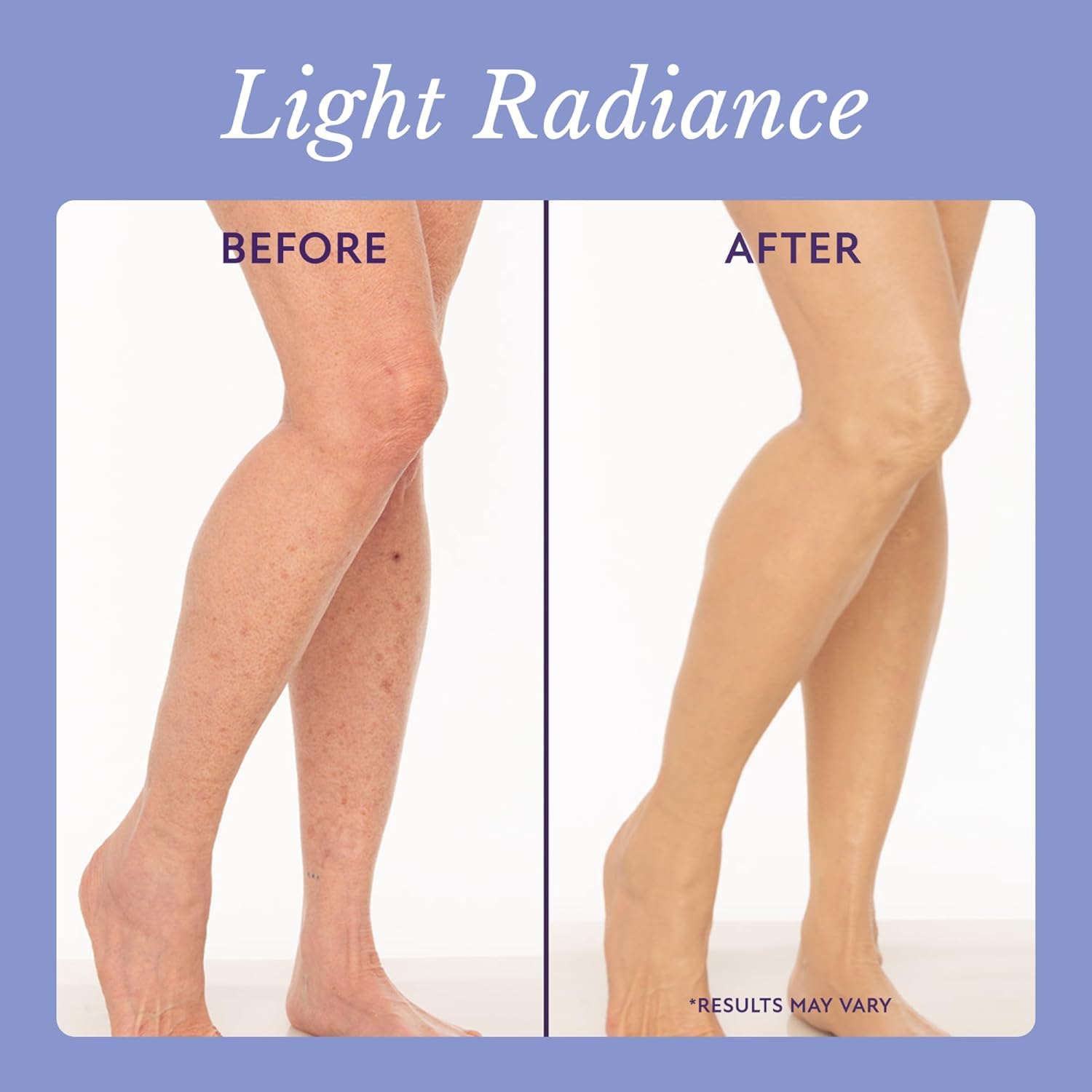 Fondotinta perfezionatore per tutto il corpo, fondotinta corpo che non sbiadisce, copre le cicatrici del corpo, effetto naturale e waterproof, adatto a corpo e gambe.