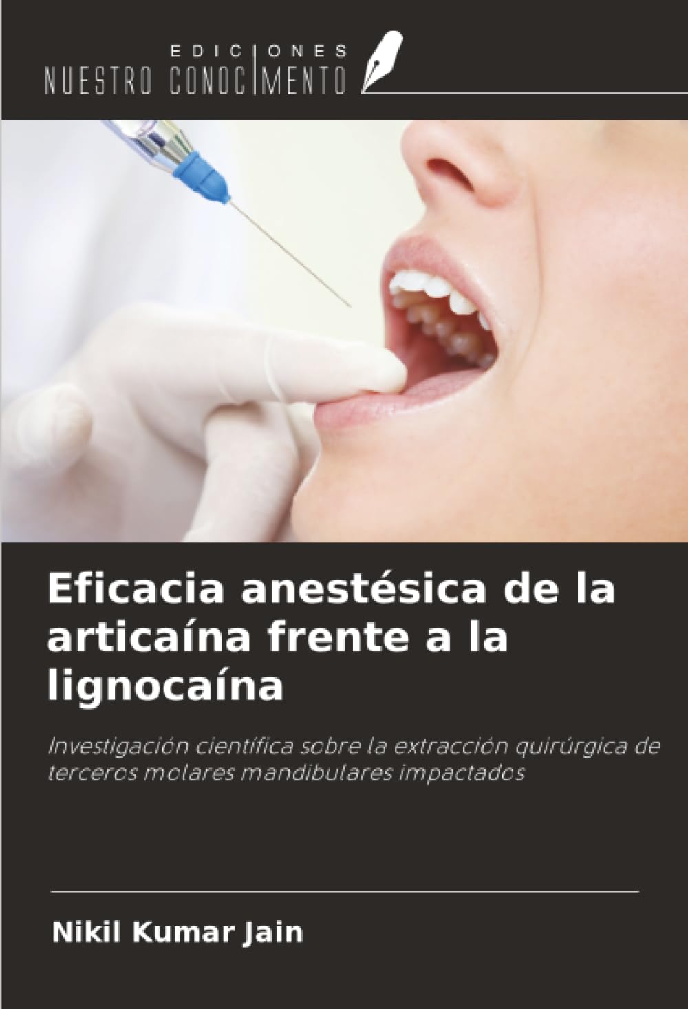 Eficacia anestésica de la articaína frente a la lignocaína: Investigación científica sobre la extracción quirúrgica de terceros molares mandibulares impactados