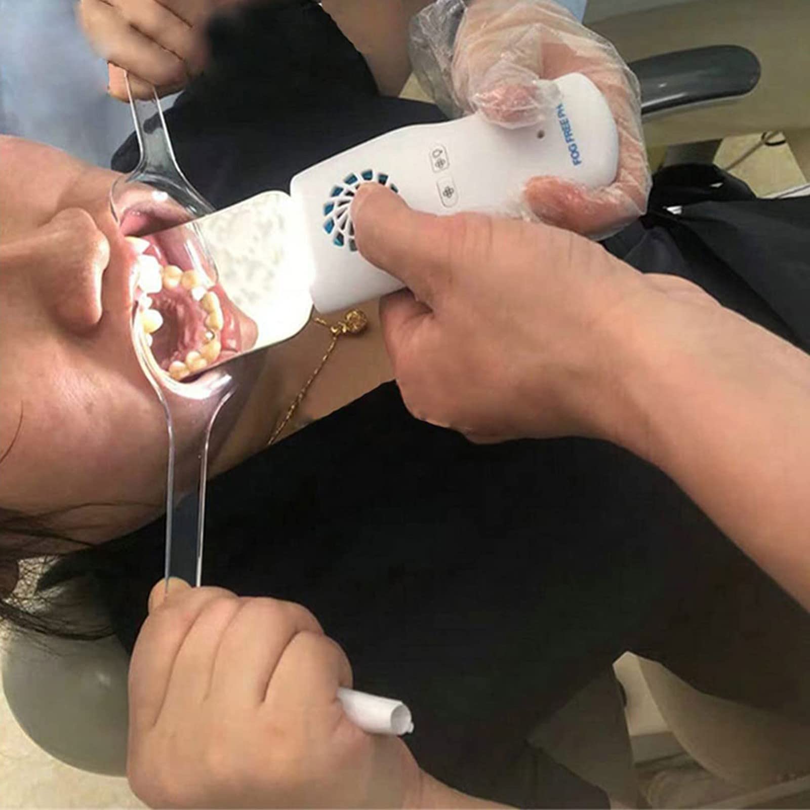 Lusterko do fotografii dentystycznej, przeciwmgielne, lusterko LED do kliniki dentystycznej, zębów, ust, reflektor, do fotografii, narzędzia dentystyczne