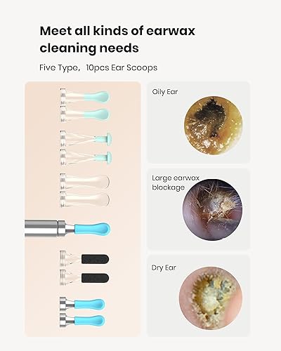 Miniatura 4 de BEBIRD R1 - Herramienta de eliminación de cera para oído, limpiador de canal auditivo con cámara 1080P, selector de orejas con puntas de repuesto