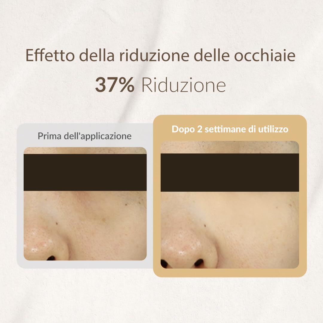 [MIZON] SNAIL REPAIR EYE CREAM (25ml) Cura coreana - Crema contorno occhi rigenerante - Anti-invecchiamento & correttore - Brillante e compattezza - Estratto di bava di lumaca
