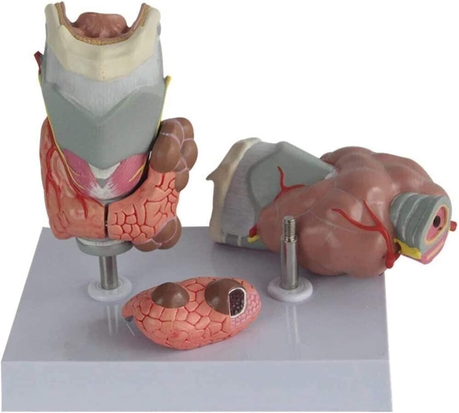 Model patologii tarczycy, nadczynność tarczycy i niedoczynność tarczycy, anatomiczna pomoc dydaktyczna dla ludzkiego układu hormonalnego, narzędzie edukacyjne do badań anatomicznych