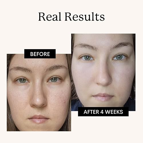 Miniatura 2 de FLEUR & BEE Hidratante de retinol | Limpio, 100% vegano | Crema antienvejecimiento, crema de retinol para cara, mejor para noche y día, para mujeres