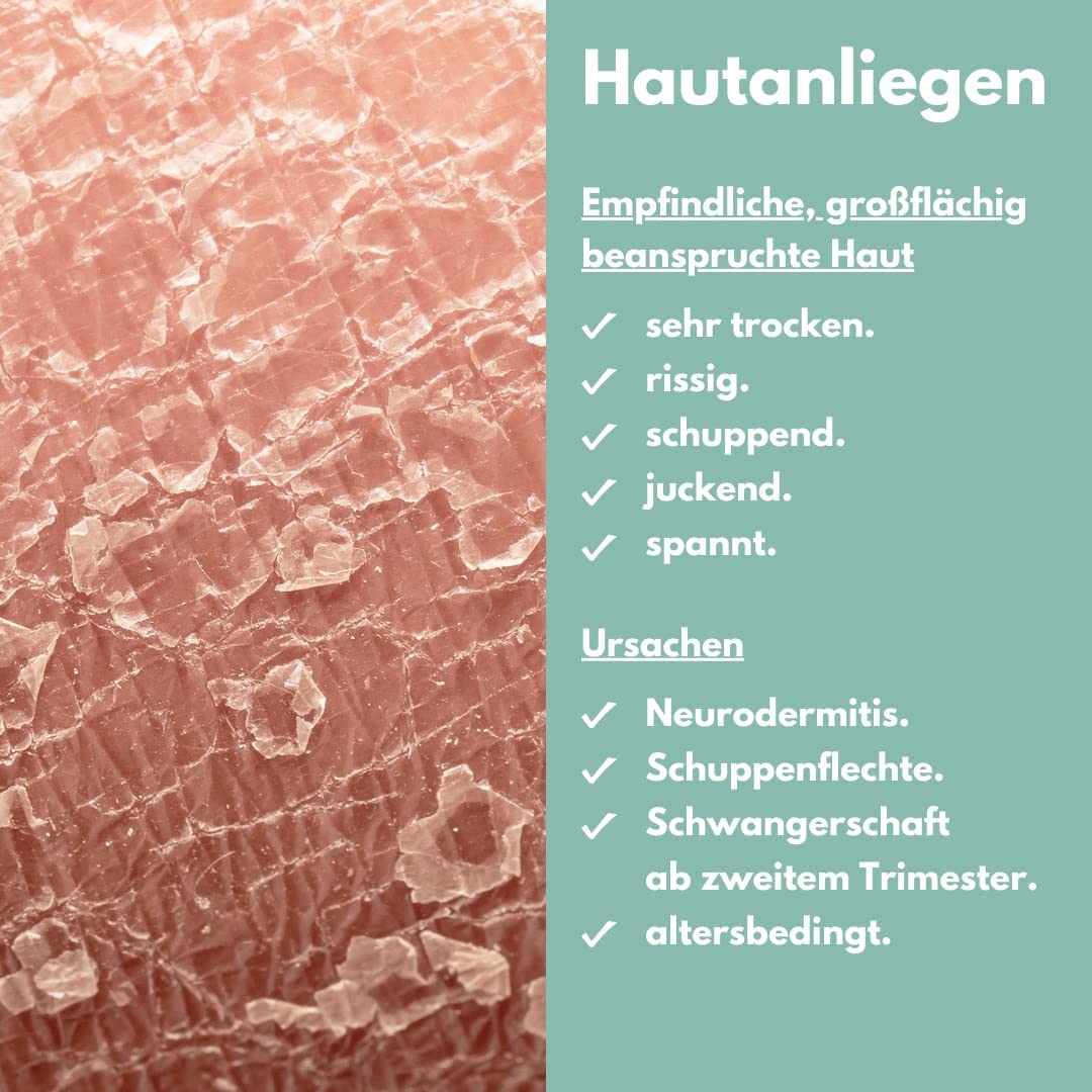 benevi neutral ISO-Lotion 200ml. Bodylotion für sehr trockene, rissige, empfindliche, juckende und schuppende Haut, hinterlässt angenehmen, pflegenden Schutzfilm.