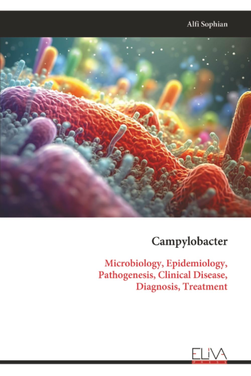 Campylobacter: Microbiology, Epidemiology, Pathogenesis, Clinical Disease, Diagnosis, Treatment
