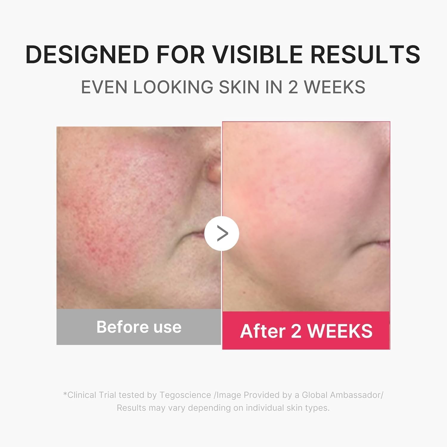 medicube Booster Pro Mini Plus | Facial Device for Radiance, Calming, and Elasticity | Red, Blue, Purple 3-Mode | Portable Korean Skincare Device, At Home Care | Beige
