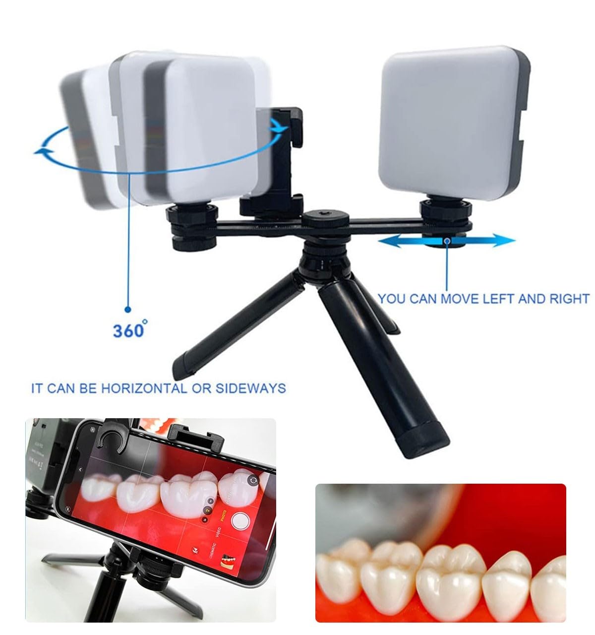 Kit de fotografía dental con luz LED para cámara de teléfono móvil, luz de relleno, flash dental brillante para odontología, clínica doméstica, hospital y estudio.(MKT-017)