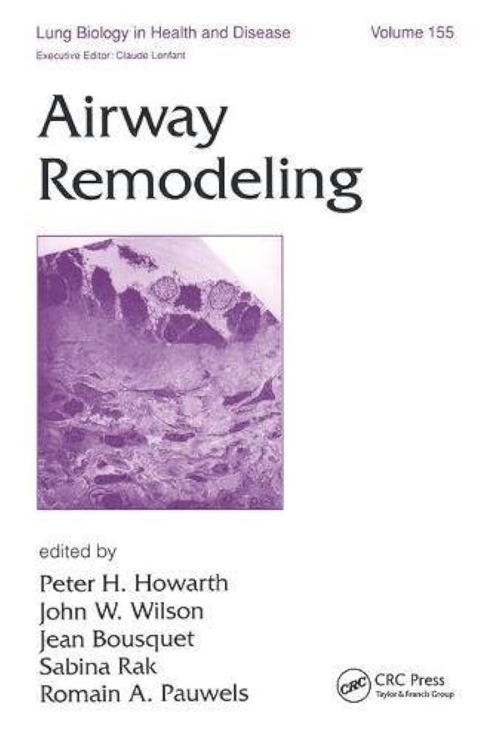 Buy Airway Remodeling, Vol. 155 — BookShops.in
