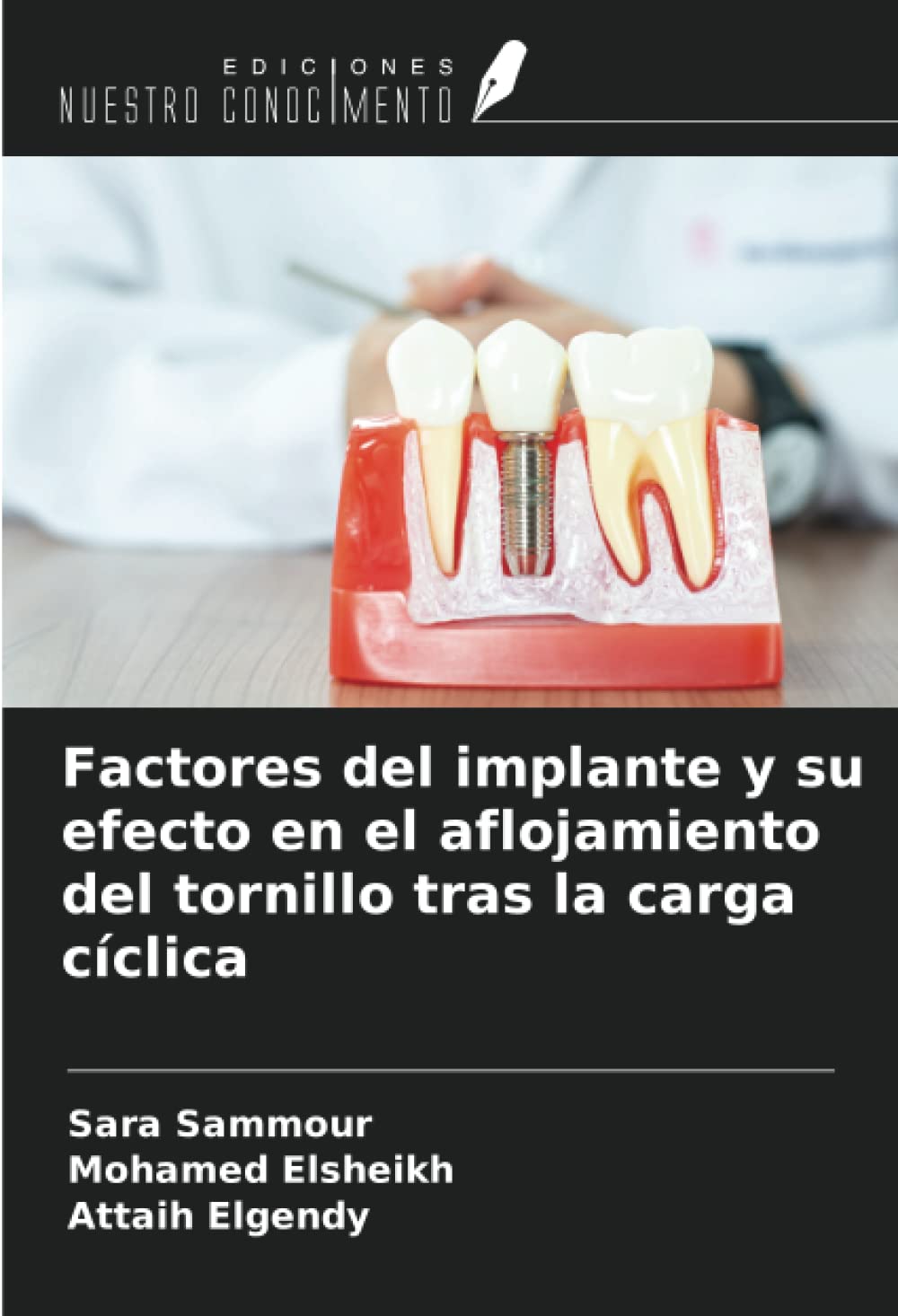 Factores del implante y su efecto en el aflojamiento del tornillo tras la carga cíclica (Spanish Edition)