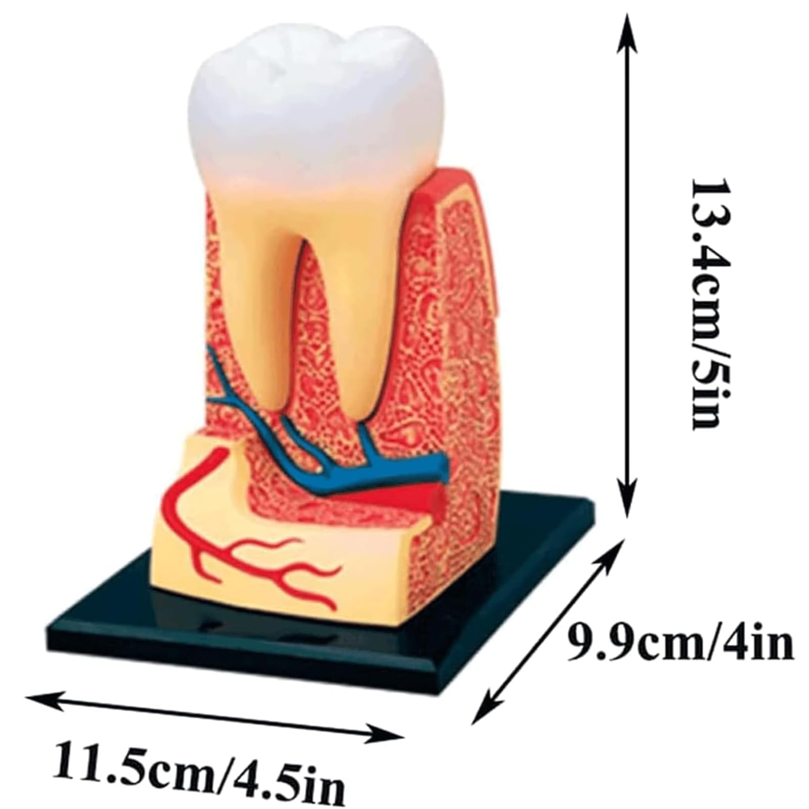 NGARY Model struktury ludzkich zębów 4D, model anatomii zębów, model zdejmowanych zębów, model demonstracyjny dentystyczny z 23 akcesoriami, do pomocy edukacyjnej