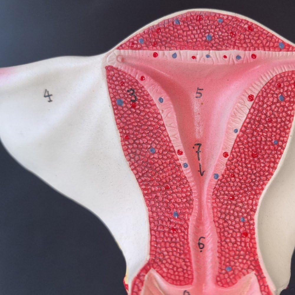 Modèle D'utérus D'ovaire Féminin Humain, Modèle D'organe Reproducteur, Modèle De Gynécologie Anatomique D'enseignement Médical Utérin D'organe Génital Féminin