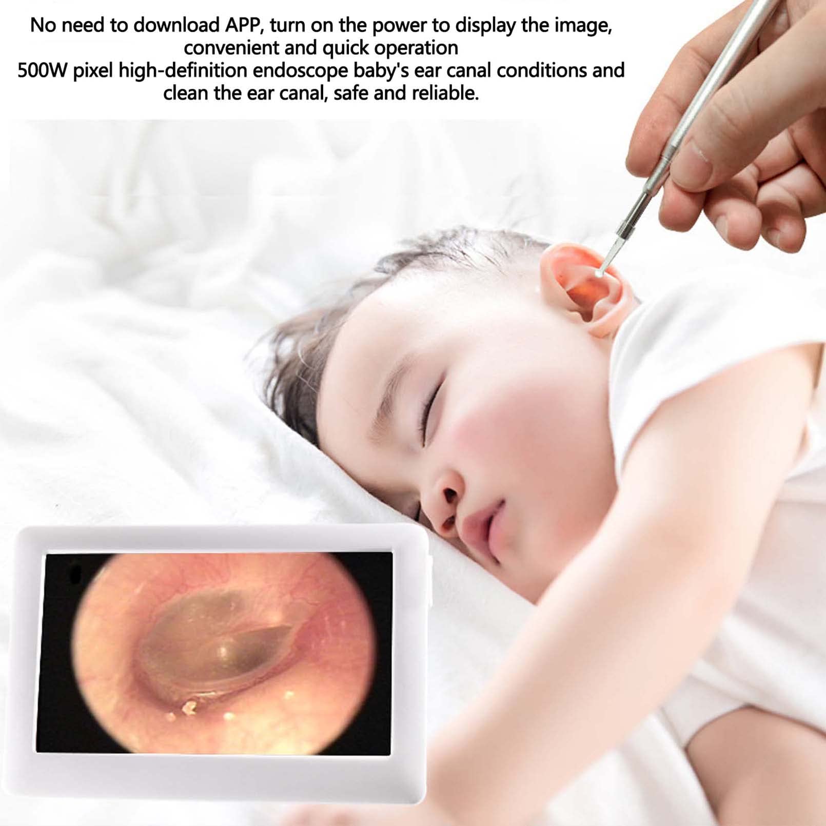 Otoscopio para Eliminación de Cera en Los Oídos de 3,9mm, Pala para la Oreja, Selección de Oreja Visible, Video HD y Foto, Otoscopio, Espejo Nasal, Endoscopio de Prueba Vaginal