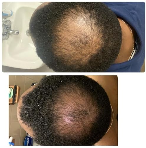 Kreyòl Essence 0859826002701 Kreyol Essence - Scalp Care Conditioner thumb #4
