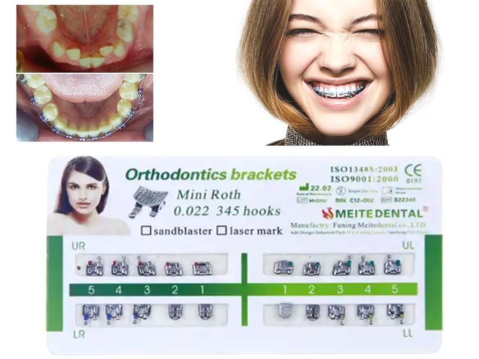 Soportes De Ortodoncia Dentales Con Ranura Para Dientes De - Foto 4