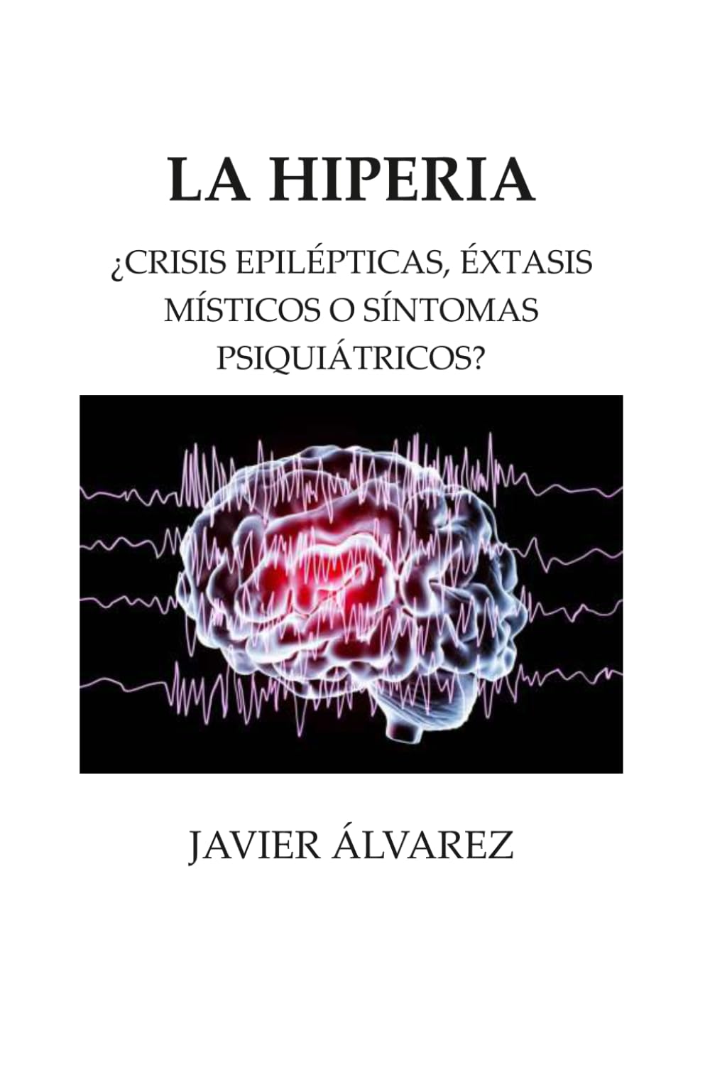 LA HIPERIA: ¿CRISIS EPILÉPTICAS, ÉXTASIS MÍSTICOS O SÍNTOMAS PSIQUIÁTRICOS?