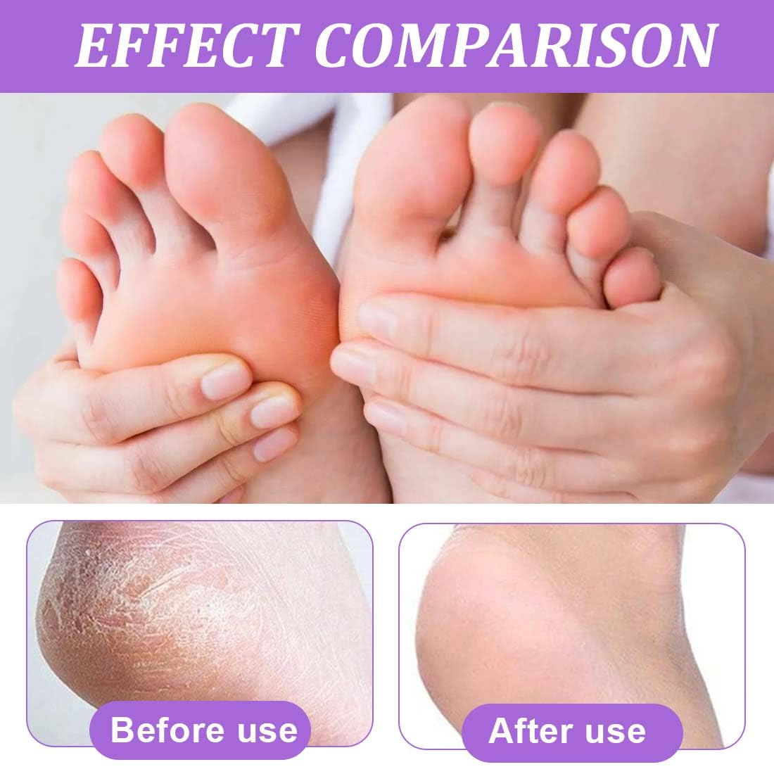 2 Paires masque pieds peeling exfoliant, Masque peeling pied, Callus peeling pieds
