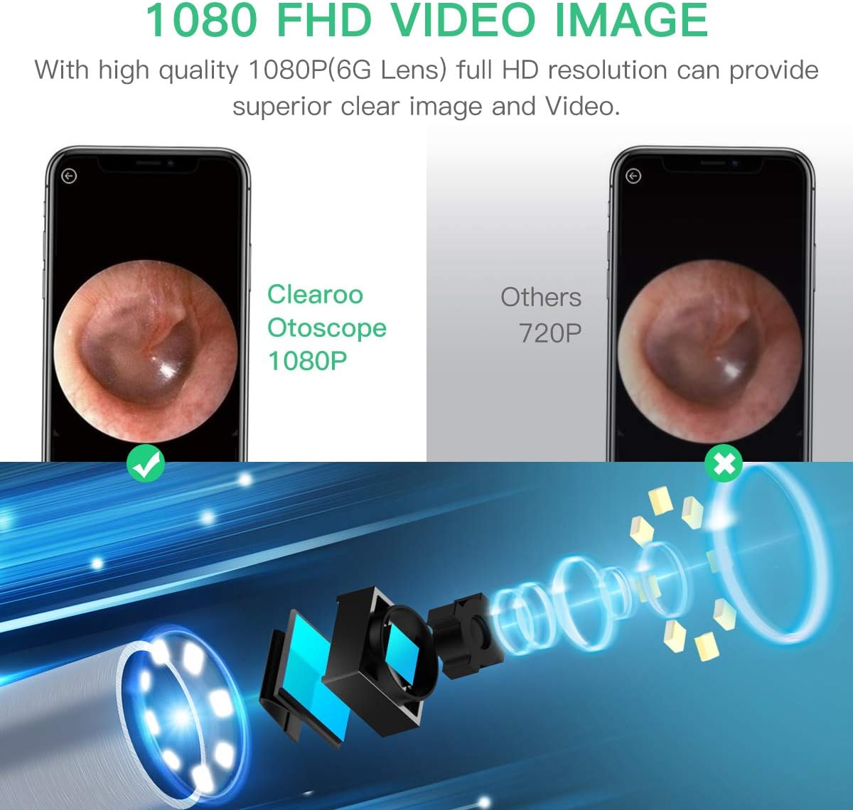 Ear Wax Removal, Earwax Remover Tool, Ear Camera, Ear Scope with Ear Wax Cleaner Tool Compatible with iPhone, iPad, Android Smart Phones (Blue) : Health & Household