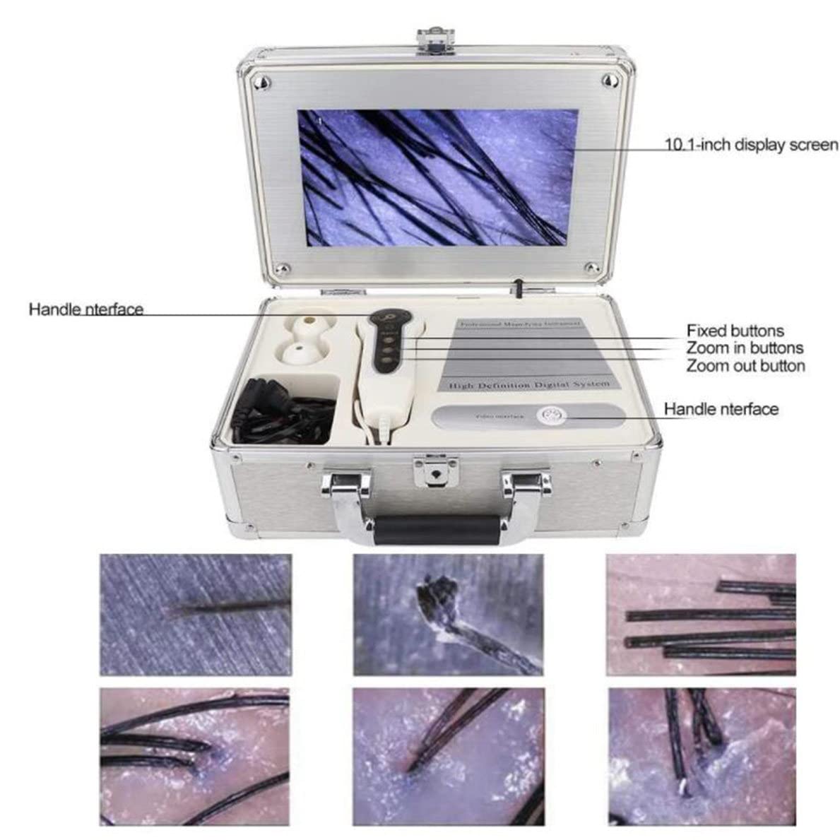 Analyseur de cheveux de diagnostic de peau, écran LCD de 10,1 pouces, type de charge numérique