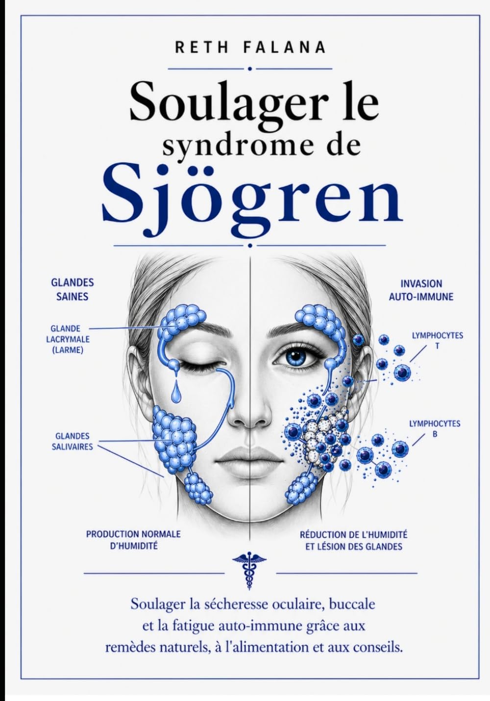Soulager le syndrome de Sjögren: Soulager la sécheresse oculaire, buccale et la fatigue auto-immune grâce aux remèdes naturels, à l'alimentation et aux conseils.