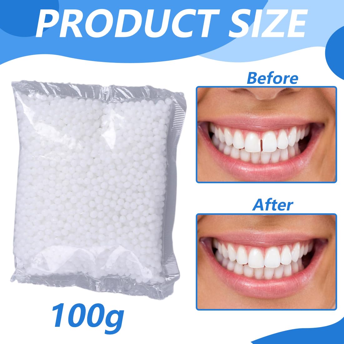GXGM 100g Cemento per Denti Perline Temporanee di Riparazione dei Denti,Kit Riparazione Denti,Materiale di Riempimento Dei Denti Dental per Otturazioni,Cavità e Denti Scheggiati