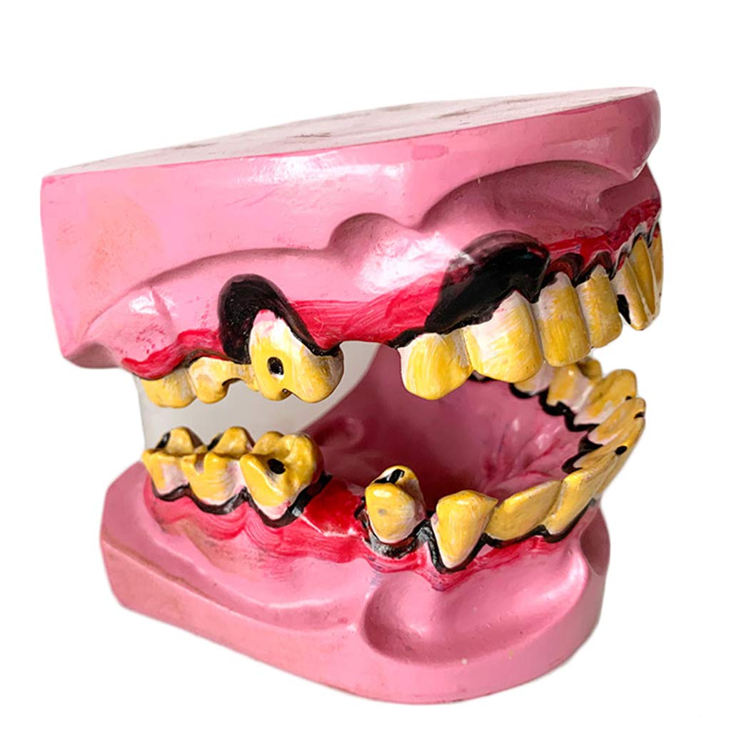 Sjdopulse Human Smokers Pathological Tooth Oral Model - Education Dental Model - Dental Disease Demonstration Study Teaching Teeth Model - For Medical Educational Training Aid