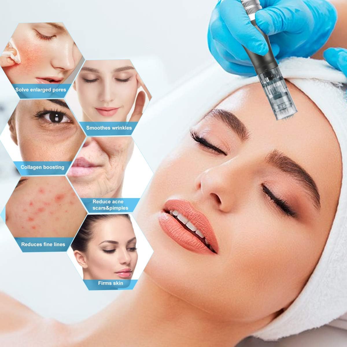 Dermapen Ultima M8 Microneedling, Dermapen Elektrischer Stift drahtlos M8 Mikronadel mit 36PIN x1, 11PIN x1 und Nano Round x1 Nadeln & Aufbewahrungsbox für Falten, Streifen, Narden und Haarausfall